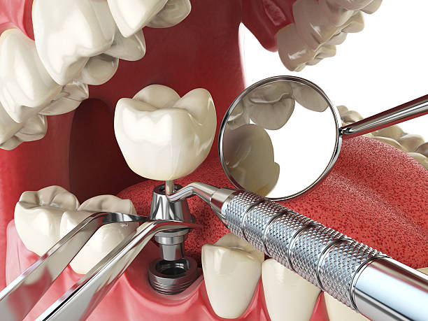 Best Broken or Cracked Tooth Emergency Dentist in Seneca, KS